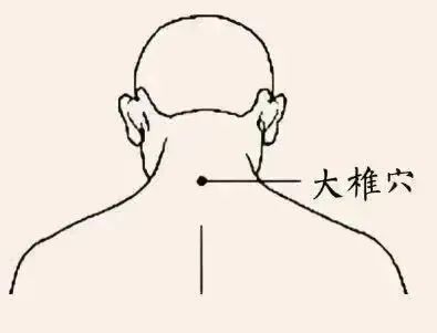 转存图片