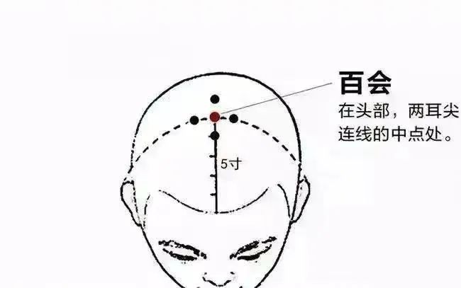 转存图片